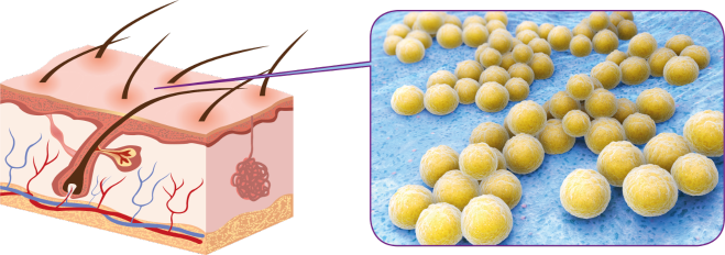 Staphyloccocus Illustration